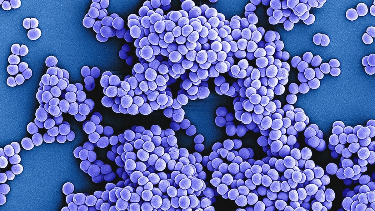Methicillin-Resistant Staphylococcus aureus (MRSA) Bacteria Colorized image of Methicillin-resistant Staphylococcus aureus (MRSA) bacteria; from a scanning electron micrograph captured at the NIAID Integrated Research Facility (IRF) in Fort Detrick, Maryland. Credit: NIAID https://www.flickr.com/photos/niaid/53346224677/